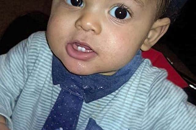 A pathologist’s report said the injury was not accidental.