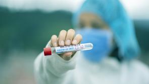 Increase in daily Covid-19 case numbers, as hospitalisation figure falls