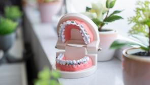 Four-year wait times and no specialist orthodontist for Clare patients