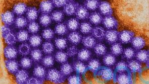 Norovirus cases up over 50% in a week &ndash; HSE