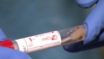 New Covid-19 cases detected in local hospitals