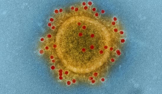 Covid-19 cases continue sharp rise as daily numbers released