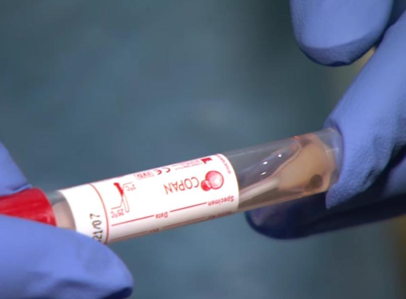 New Covid-19 cases detected in local hospitals