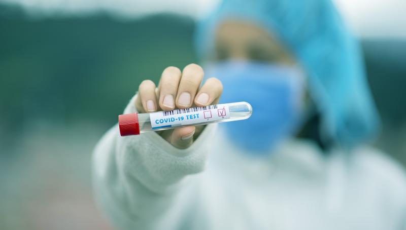 Department of Health confirms slight increase in national daily covid figures