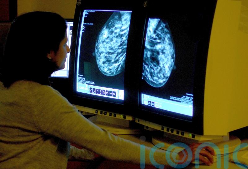 HSE says &lsquo;problem&rsquo; with viewing BreastCheck register will be fixed next week
